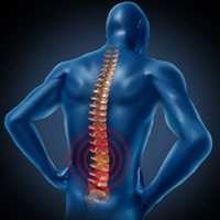 Baltimore Car Accident Lawyers discuss spinal cord injuries resulting from car accidents. 
